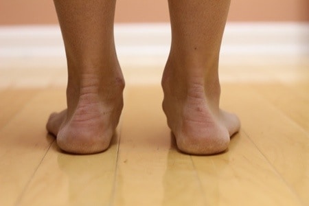 https://bestwalkingfeet.com/wp-content/uploads/2014/11/flat-feet1.jpg