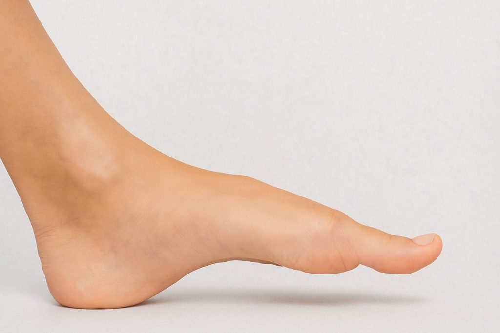 foot - supination and high arches