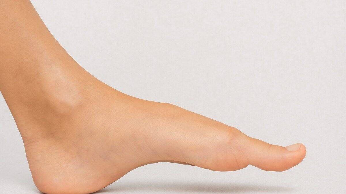 high arches and supination - foot