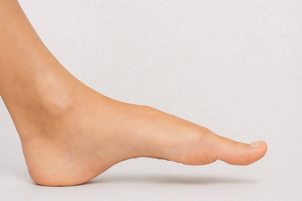 high arches and supination - foot