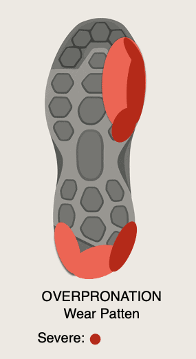Overpronation Shoe Wear