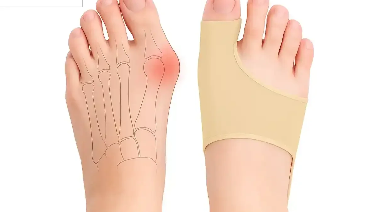 bunion remedy
