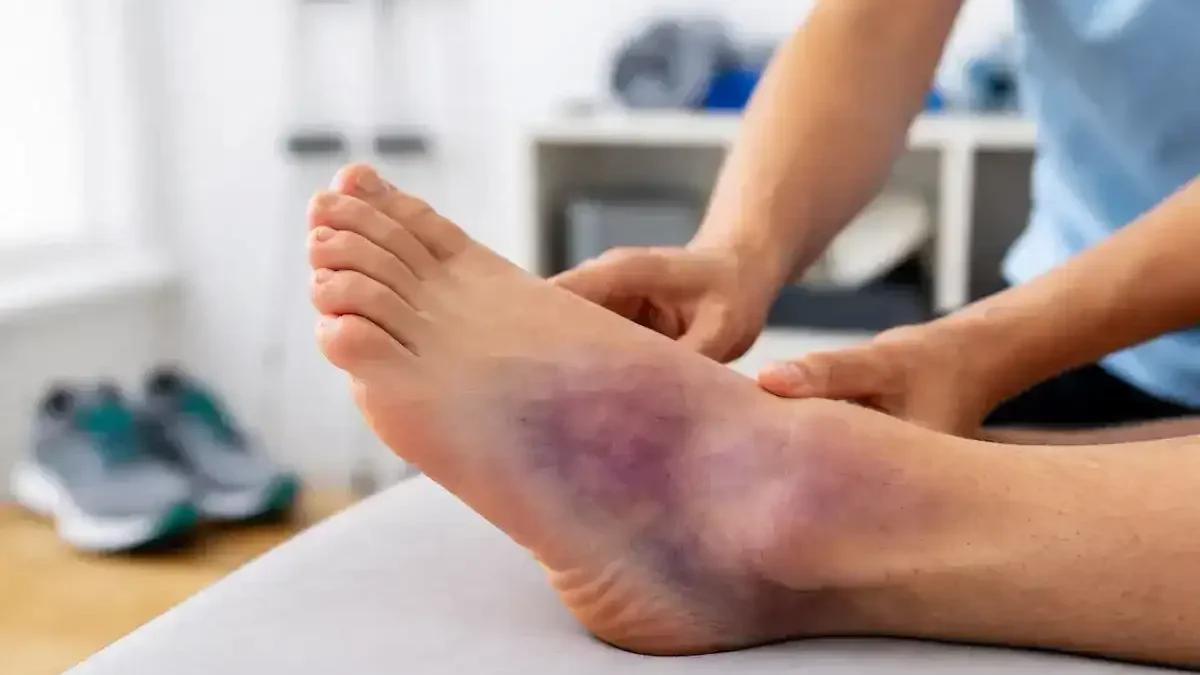 lisfranc sprain