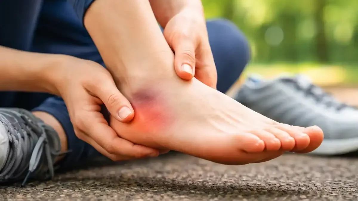 heel contusion